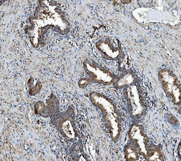 a04589 1 rab1b primary antibodies ihc testing 2