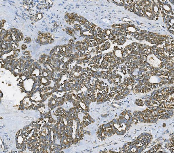 a04589 1 rab1b primary antibodies ihc testing 4