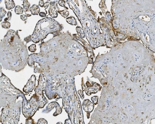 a04589 1 rab1b primary antibodies ihc testing 5