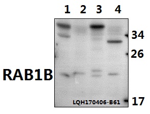 a04589 rab1b primary antiboties wb testing 1