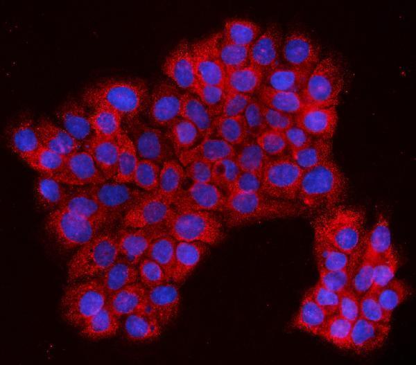  IF analysis of EVI1/MECOM using anti-EVI1/MECOM antibody (A04590-1)