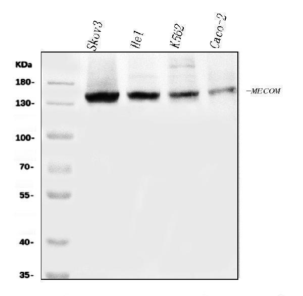  Western blot analysis of EVI1/MECOM using anti-EVI1/MECOM antibody (A04590-1)