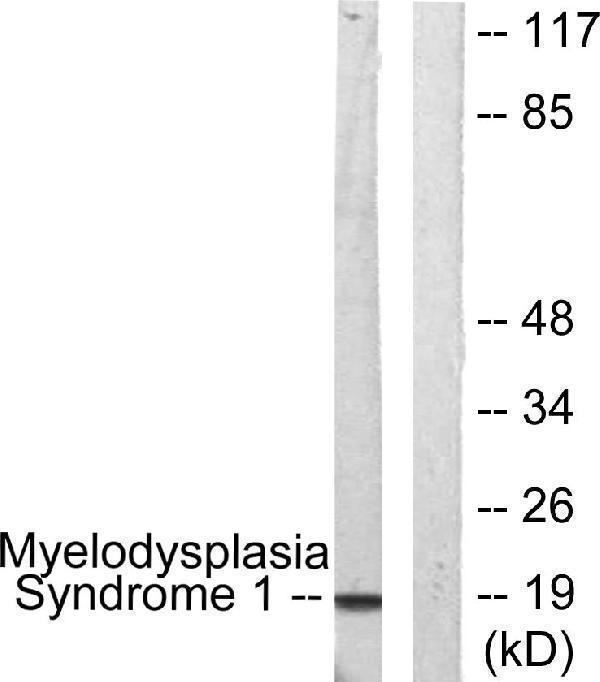Western blot analysis of lysates from A549 cells, using Myelodysplasia Syndrome 1 Antibody