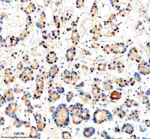  IHC analysis of CREB3L2 using anti-CREB3L2 antibody (A04591-1)