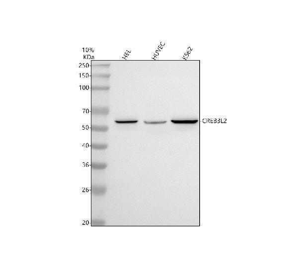  Western blot analysis of CREB3L2 using anti-CREB3L2 antibody (A04591-1)
