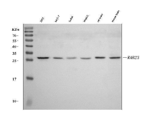  Western blot analysis of RAB23 using anti-RAB23 antibody (A04593-2)