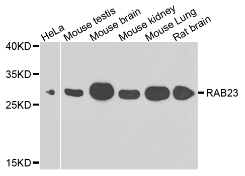 Western blot analysis of extracts of various cell lines, using RAB23 antibody