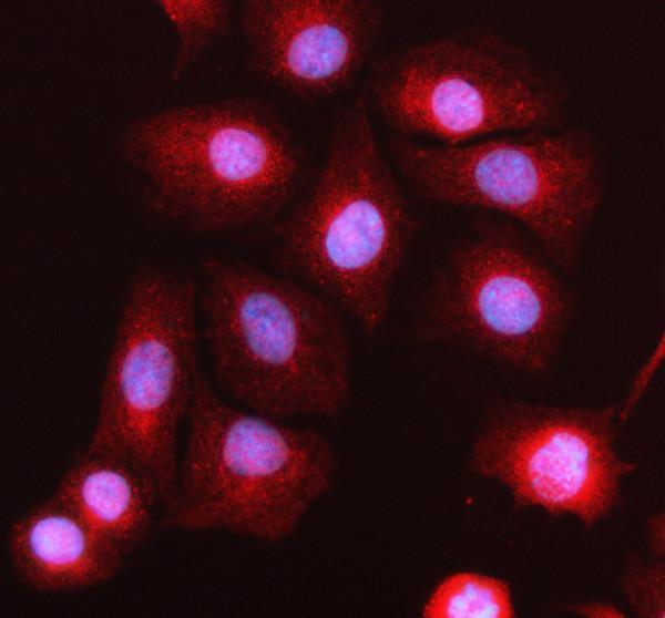 a04594 kif18a primary antibodies if testing 1
