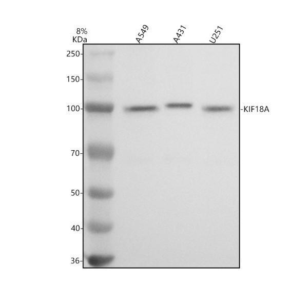 a04594 kif18a primary antibodies wb testing 1