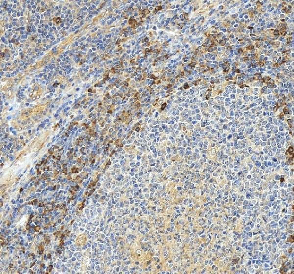 a04595 1 gp9 primary antibodies ihc testing 1