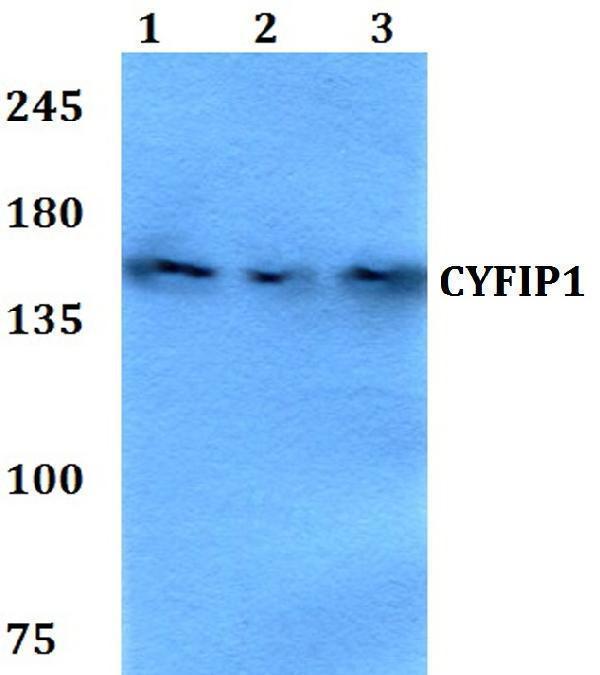 a04596 cyfip1 primary antiboties wb testing 1
