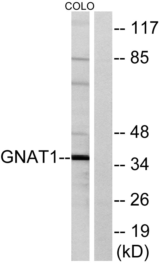 a04598 1 gnat1 primary antibodies wb testing 1