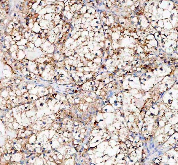  IHC analysis of PLOD2 using anti-PLOD2 antibody (A04601-2)