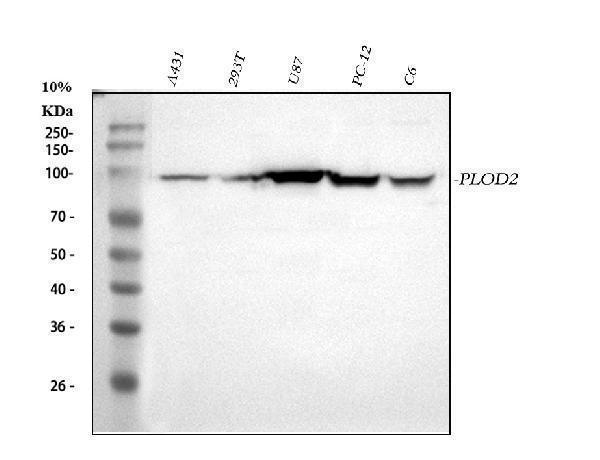  Western blot analysis of PLOD2 using anti-PLOD2 antibody (A04601-2)