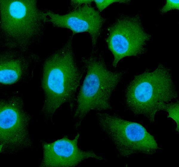 a04604 1 eif5b primary antibodies if testing 1