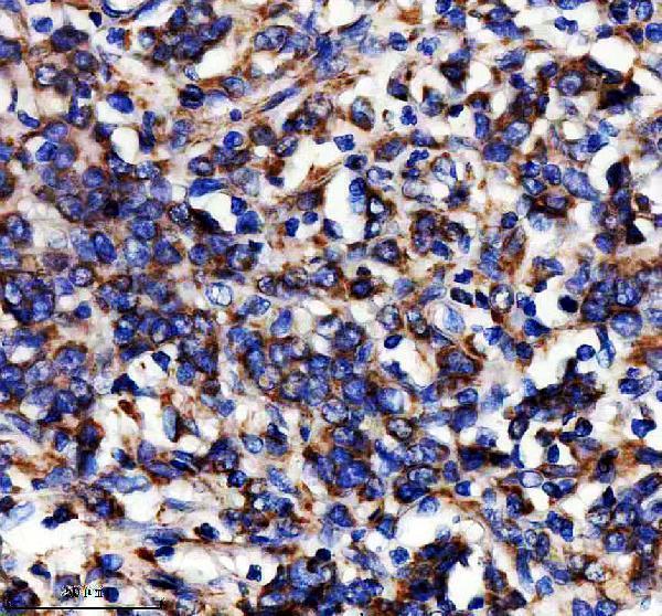 a04604 1 eif5b primary antibodies ihc testing 1