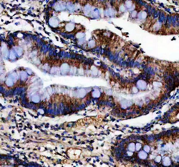 a04604 1 eif5b primary antibodies ihc testing 2