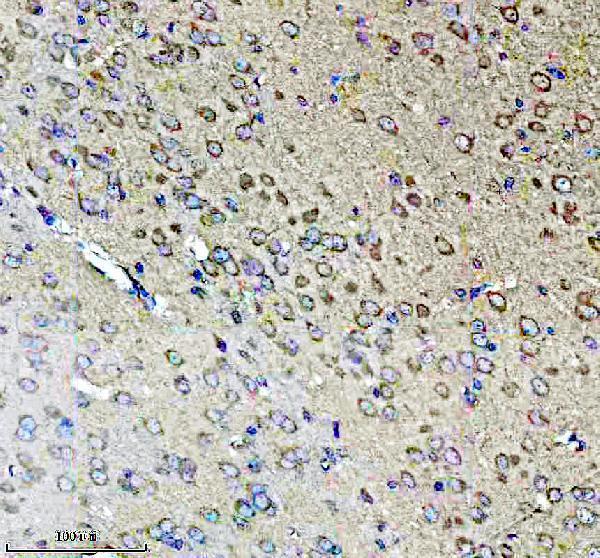 a04604 1 eif5b primary antibodies ihc testing 3