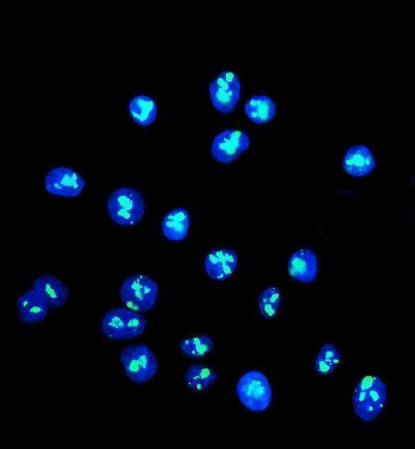  IF analysis of DDX21 using anti-DDX21 antibody (A04605-2)
