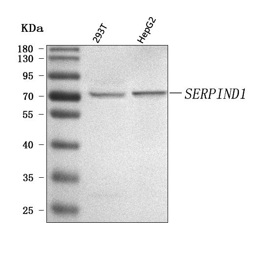  Western blot analysis of SERPIND1 using anti-SERPIND1 antibody (A04607-3)