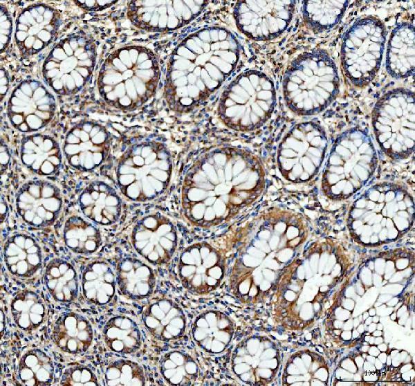 a04608 1 sgsh primary antibodies ihc testing 2