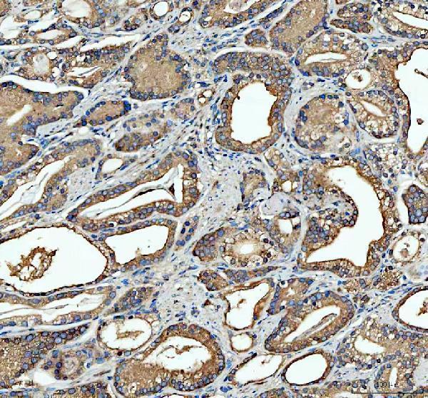 a04608 1 sgsh primary antibodies ihc testing 3