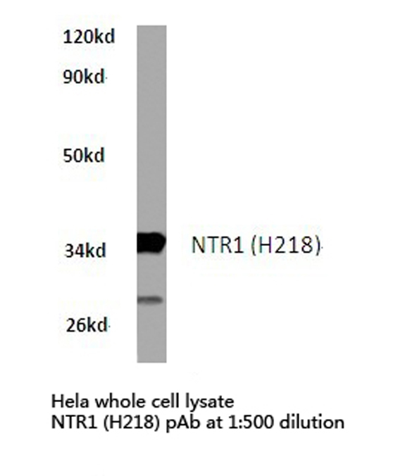 a04610 3 ntsr1 primary antiboties wb testing 1