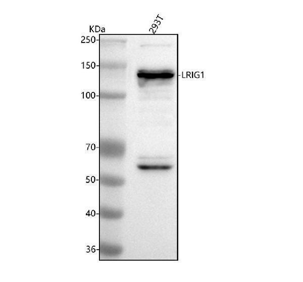  Western blot analysis of LRIG1 using anti-LRIG1 antibody (A04613-2)