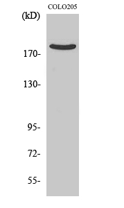 Western Blot (WB) analysis of specific cells using PDZ-RhoGEF Polyclonal antibody