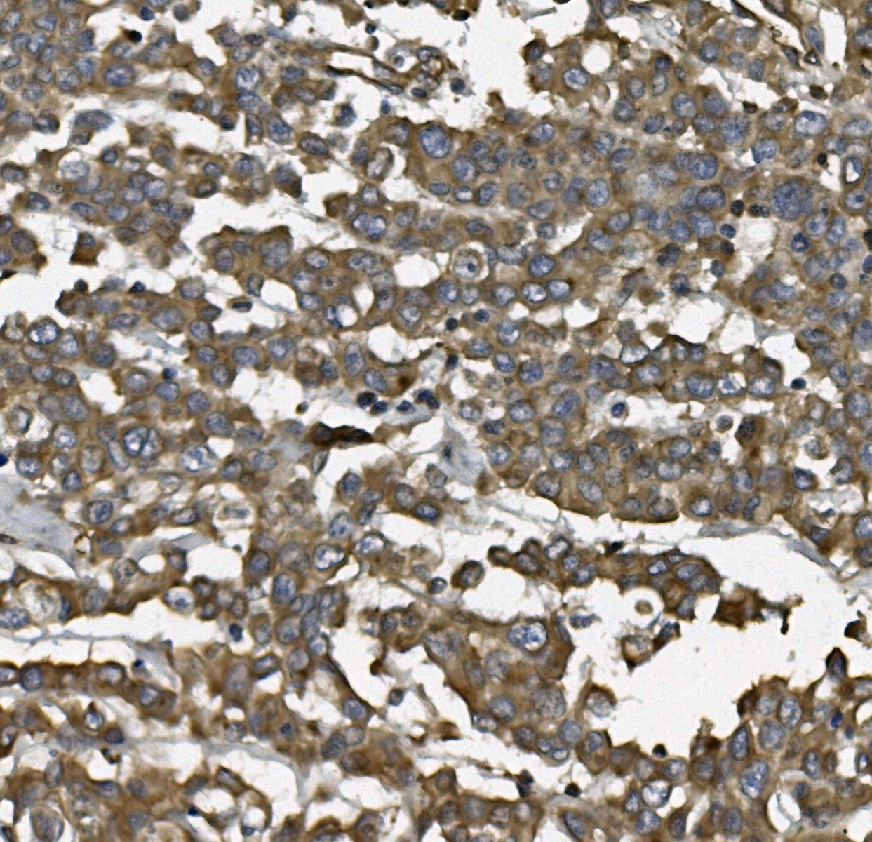 a04615 1 aldh1l1 primary antibodies ihc testing 4_1