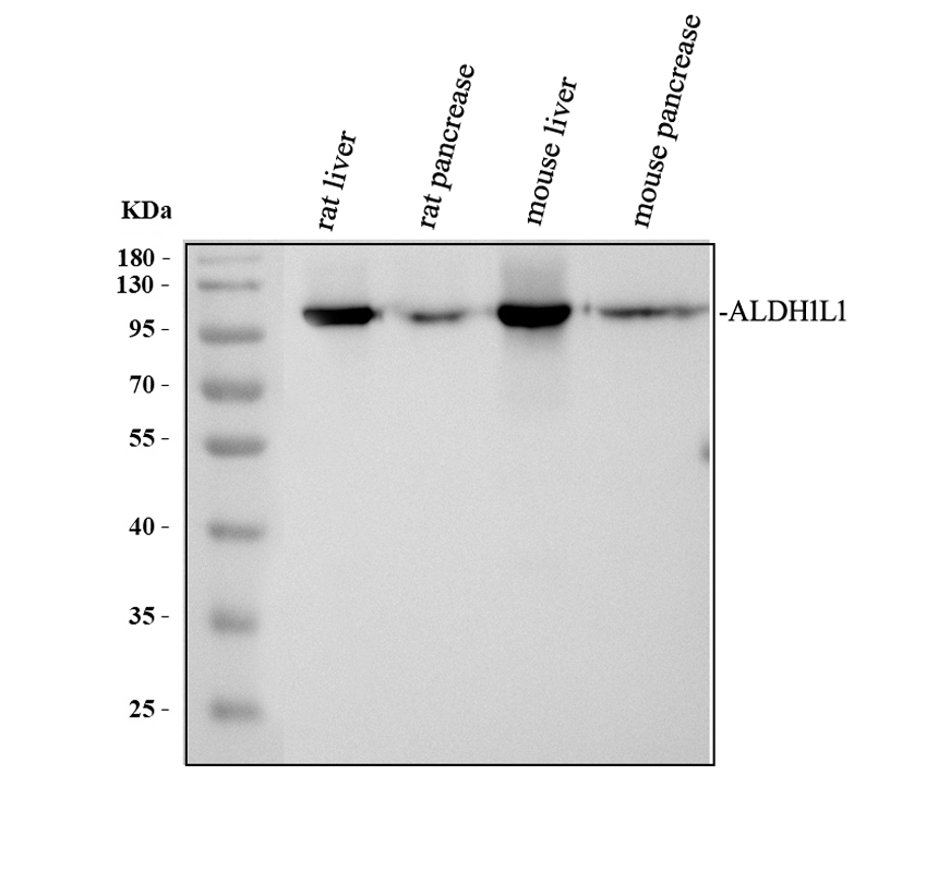 Western blot analysis of ALDH1L1 using anti-ALDH1L1 antibody (A04615-1)