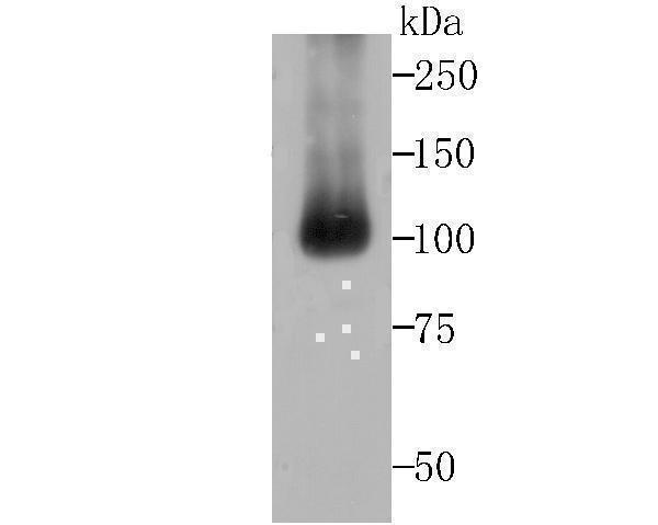 Western blot analysis of ALDH1L1 on mouse liver tissue lysates using anti-ALDH1L1 antibody at 1/500 dilution