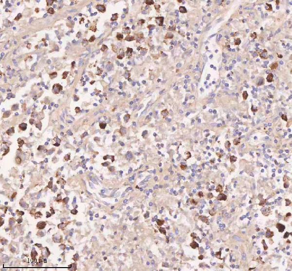 a04616 1 irs4 primary antibodies ihc testing 11