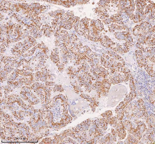 a04616 1 irs4 primary antibodies ihc testing 12