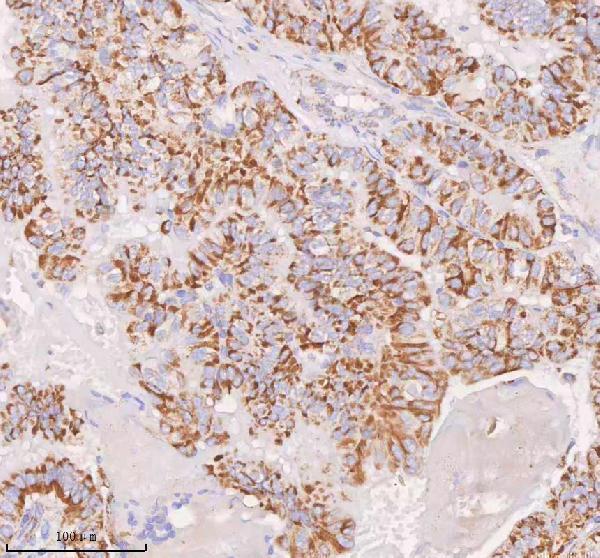 a04616 1 irs4 primary antibodies ihc testing 13