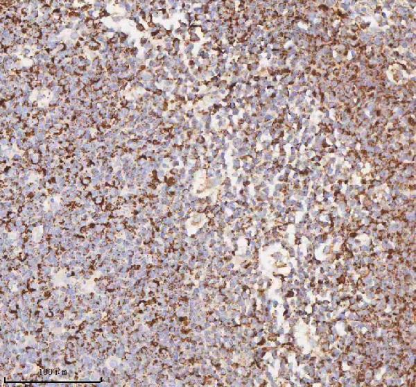 a04616 1 irs4 primary antibodies ihc testing 15