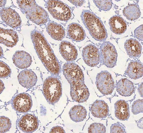 a04616 1 irs4 primary antibodies ihc testing 17