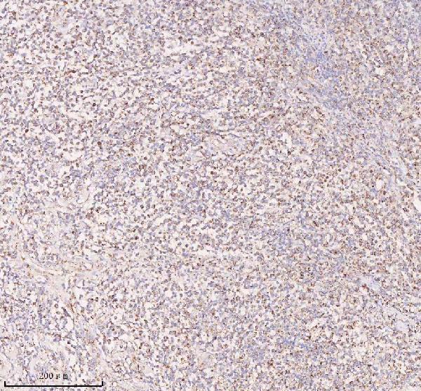  IHC analysis of IRS4 using anti-IRS4 antibody (A04616-1)