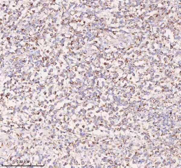  IHC analysis of IRS4 using anti-IRS4 antibody (A04616-1)