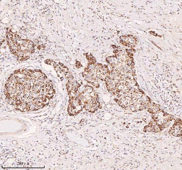 a04616 1 irs4 primary antibodies ihc testing 4