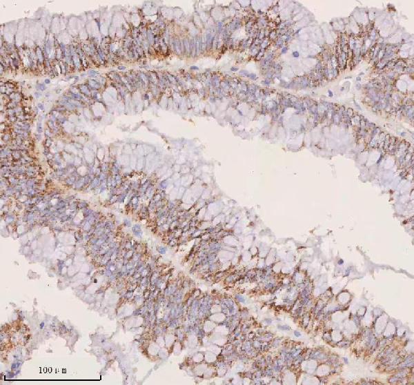 a04616 1 irs4 primary antibodies ihc testing 7