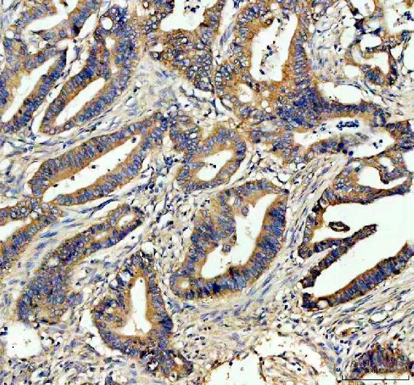 a04618 1 gars gars1 primary antibodies ihc testing 2