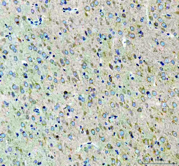 a04618 1 gars gars1 primary antibodies ihc testing 3