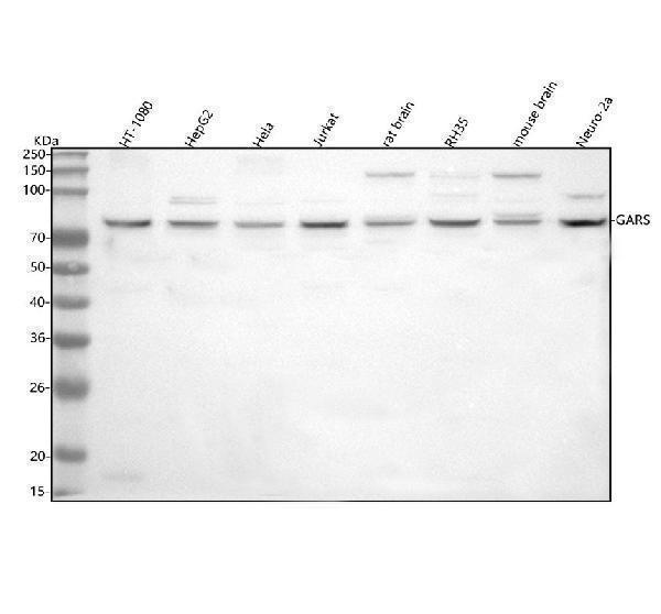  Western blot analysis of GARS1 using anti-GARS1 antibody (A04618-2)