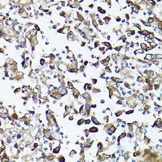 a04618 gars primary antiboties ihc testing 2
