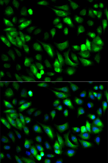 a04618 gars primary antiboties ihc testing 3