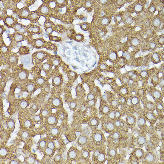 a04618 gars primary antiboties ihc testing 4