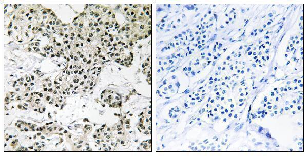 a04619 1 thoc5 primary antibodies ihc testing 1