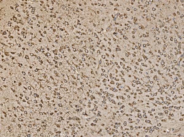 a04623 2 eif5 primary antibodies ihc testing 10