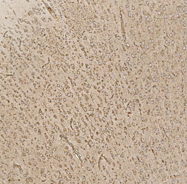a04623 2 eif5 primary antibodies ihc testing 11
